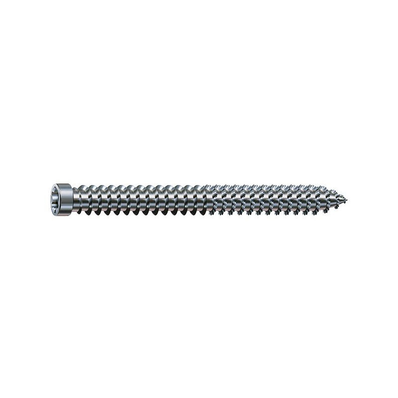 VIS DE FIXATION CHÂSSIS SPAX À TÊTE CYLINDRIQUE